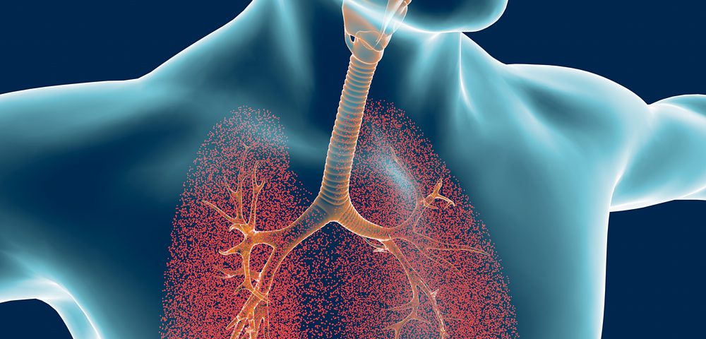 Iloprost recommend Iloprost forecast