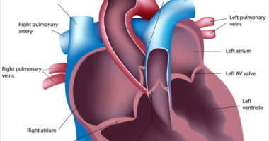 Pulmonary Hypertension and heart failure