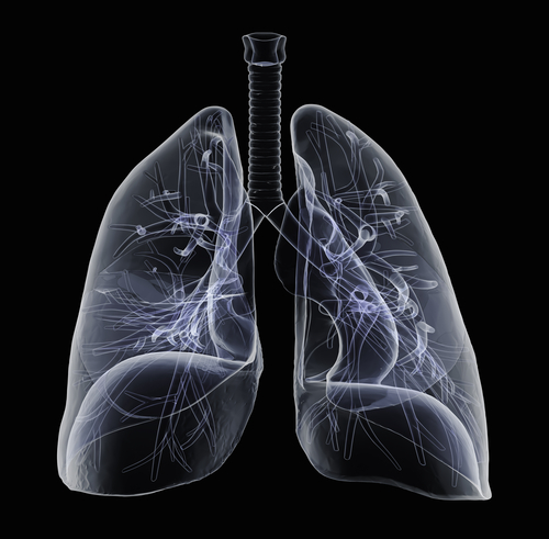 Sarcoidosis-Associated Pulmonary Hypertension Highlighted By Recent Study