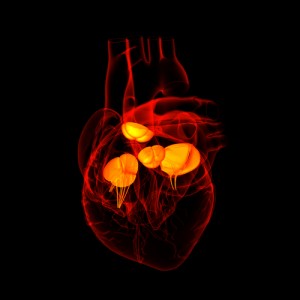 PAH and congenital heart disease