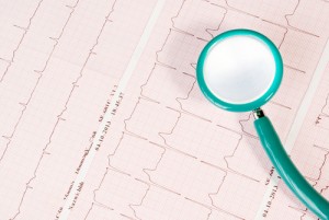 cardiac arrhythmias in PAH