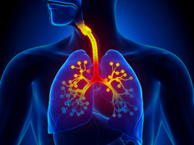 inflammation in IPF