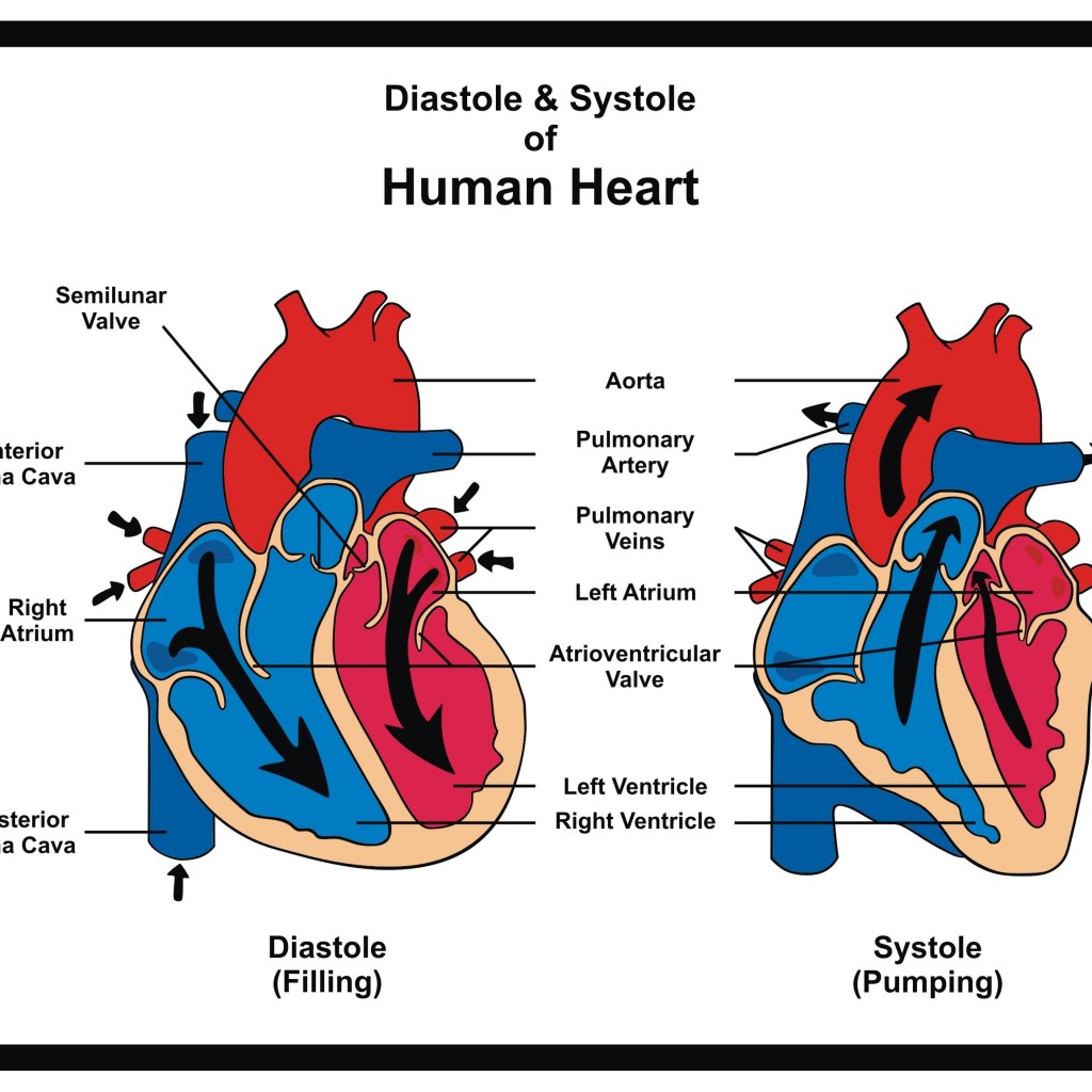 Systemic Sclerosis Patients with High Pulmonary Artery Pressure May ...