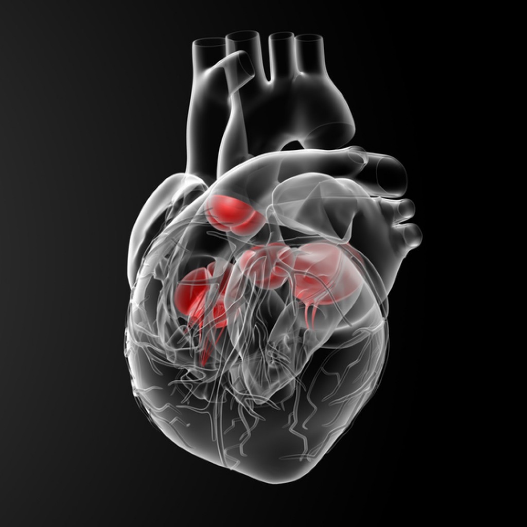 Sildenafil's Effect on Right Ventricular Function in PHRelated Heart
