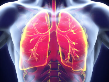 PAH disease