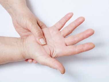 scleroderma and PAH