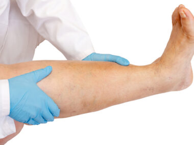 Pulmonary Hypertension and Edema