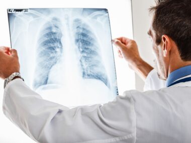 top 10 pulmonary hypertension articles 2015