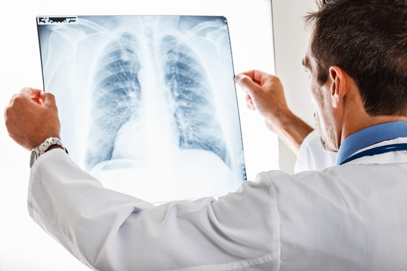 top 10 pulmonary hypertension articles 2015