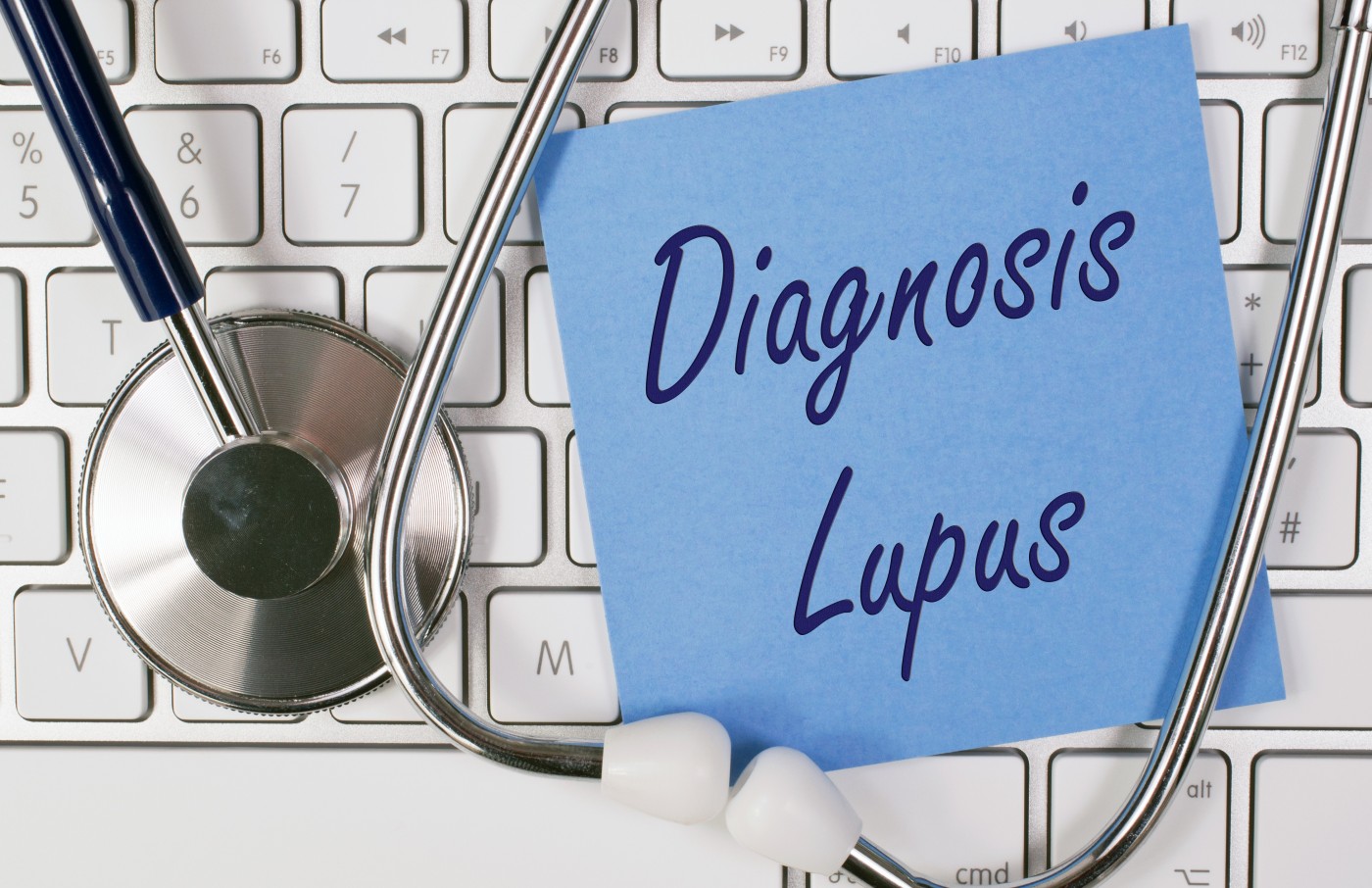 lupus and PAH