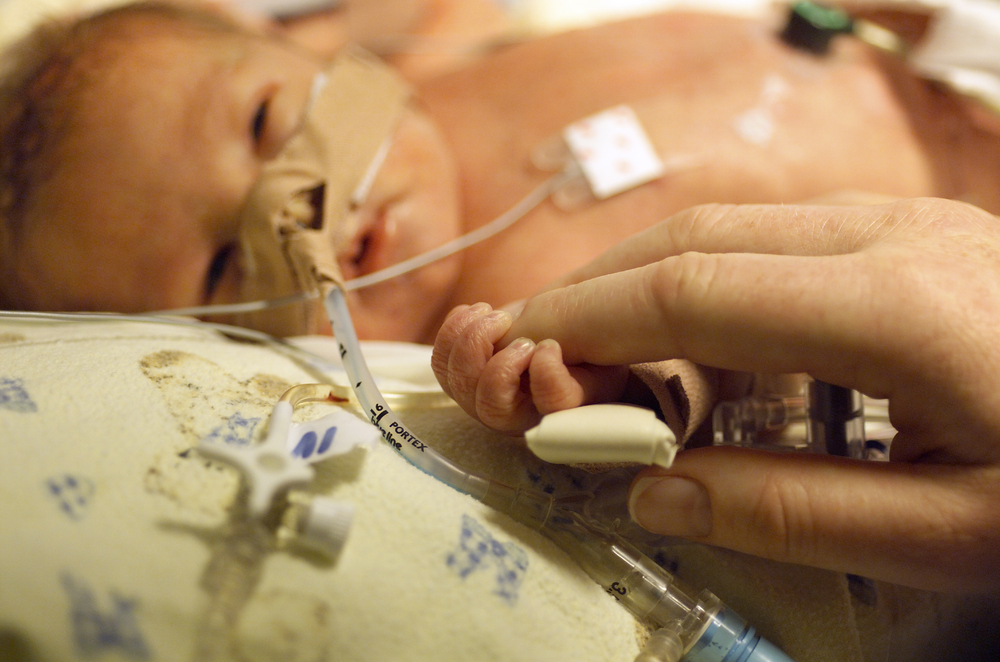 What Causes Chronic Lung Disease In Premature Babies