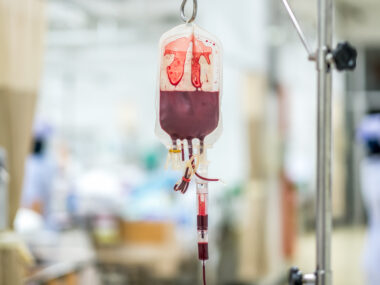 blood transfusion