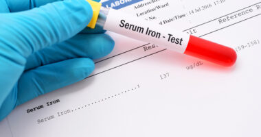 Iron deficiency and PH