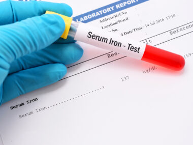 Iron deficiency and PH