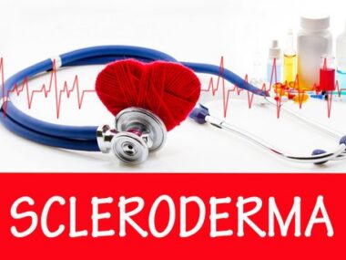 adipsin biomarker in PAH-SSc