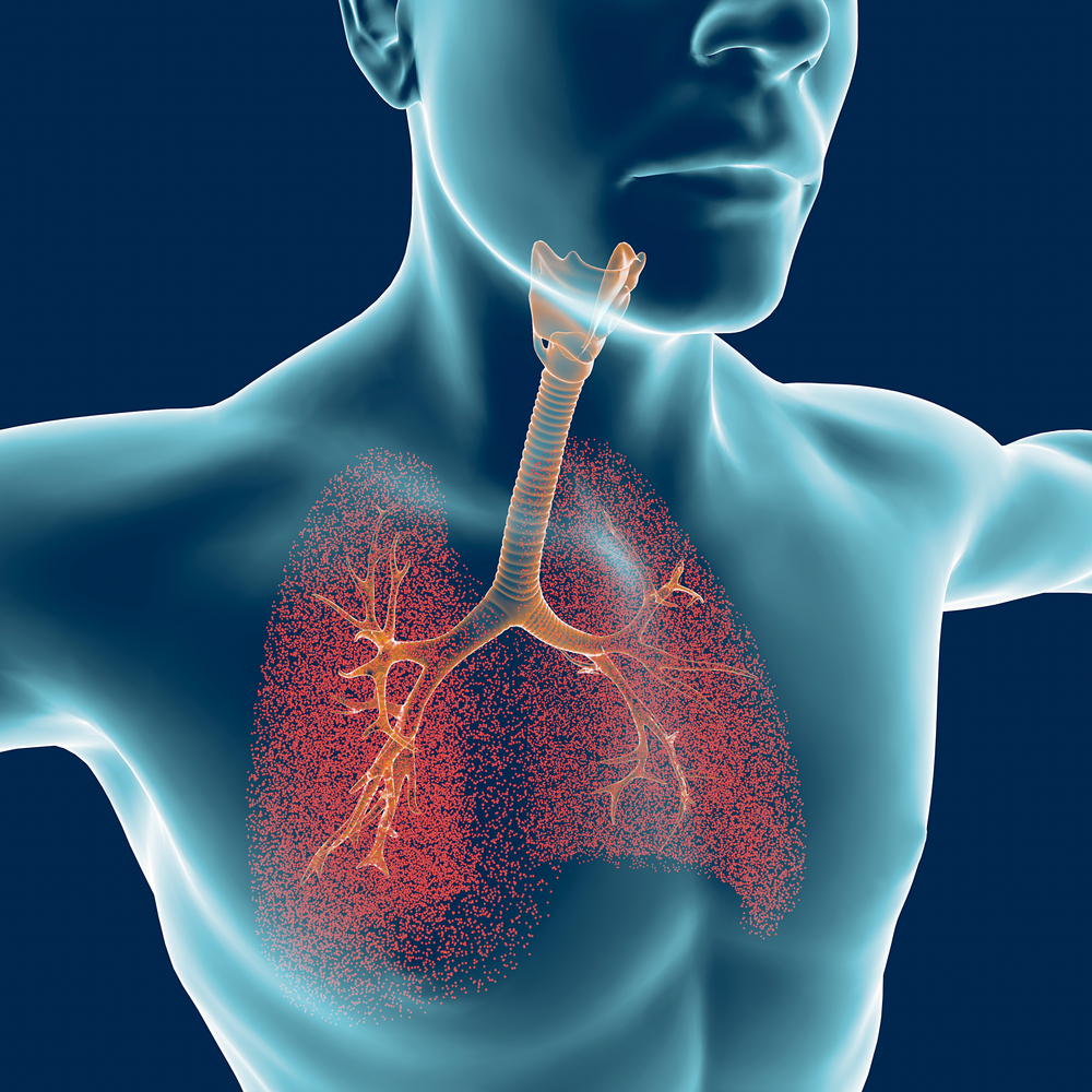 lung infections and PAH