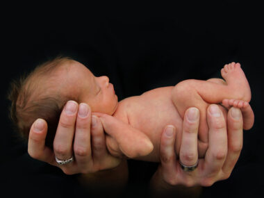 persistent pulmonary hypertension of the newborn