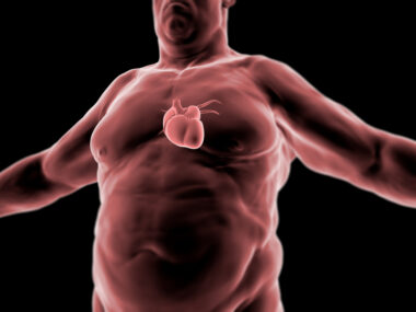 PH and obesity