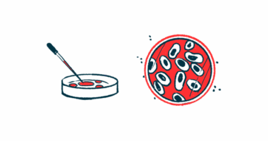 A dropper is seen poised above one petri dish while an aerial view shows cells in another petri dish.