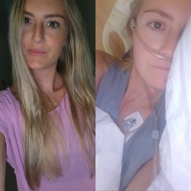 A two-photo collage; on the left a young woman with long, blond hair smiles in a selfie, wearing a pink T-shirt; on the right, the same woman lies in a hospital bed with an oxygen cannula and heart monitors. 