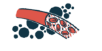 Red blood cells are shown flowing through a blood vessel.