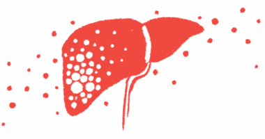 An image of a liver is shown.