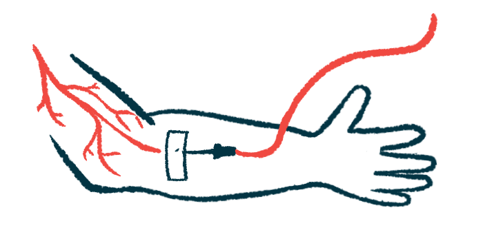 An illustration shows an arm receiving an intravenous infusion.